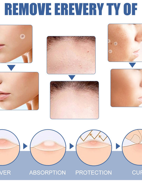 Load image into Gallery viewer, EELHOE Gram Wart Corns Patch, Skin Gram Wart Flesh Mole Black Mole Clean And Care Patch
