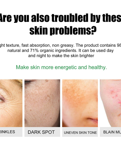 Load image into Gallery viewer, EELHOE Skin Care Cream Improves Dull Skin, Moisturizes Skin, Brightened Skin Care Cream And Clears Acne
