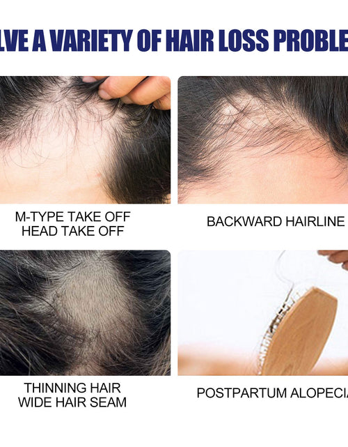Load image into Gallery viewer, Men's Dense Hair Foam Machine, Repair Hair Root Follicle Men's Hair Thick Moisturizing Foam

