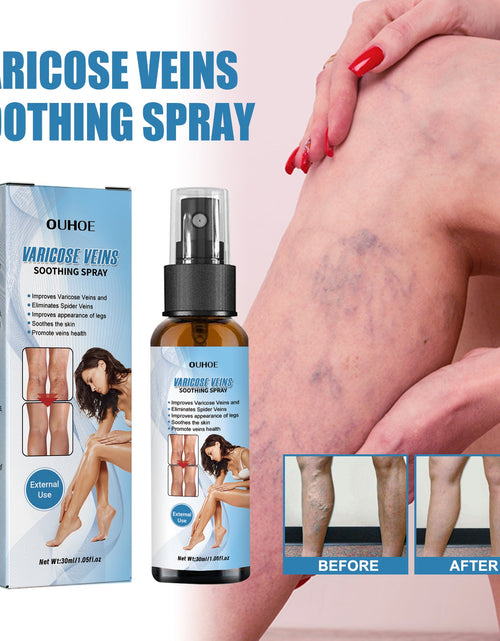 Load image into Gallery viewer, Vein Treatment Spray, Relieve Leg Soreness And Swelling Repair Earthworm Leg Vein Treatment Spray
