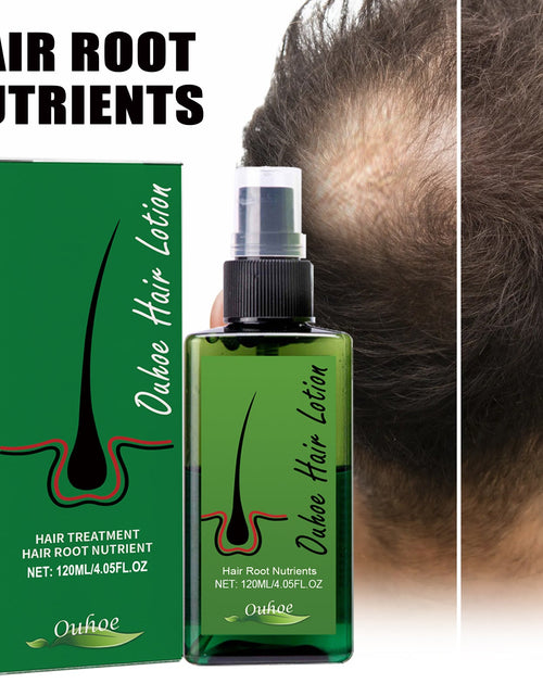 Load image into Gallery viewer, Dense Hair Spray, Anti-Loss Hair Strengthening Hair Repair Hair Root Hair Care Spray
