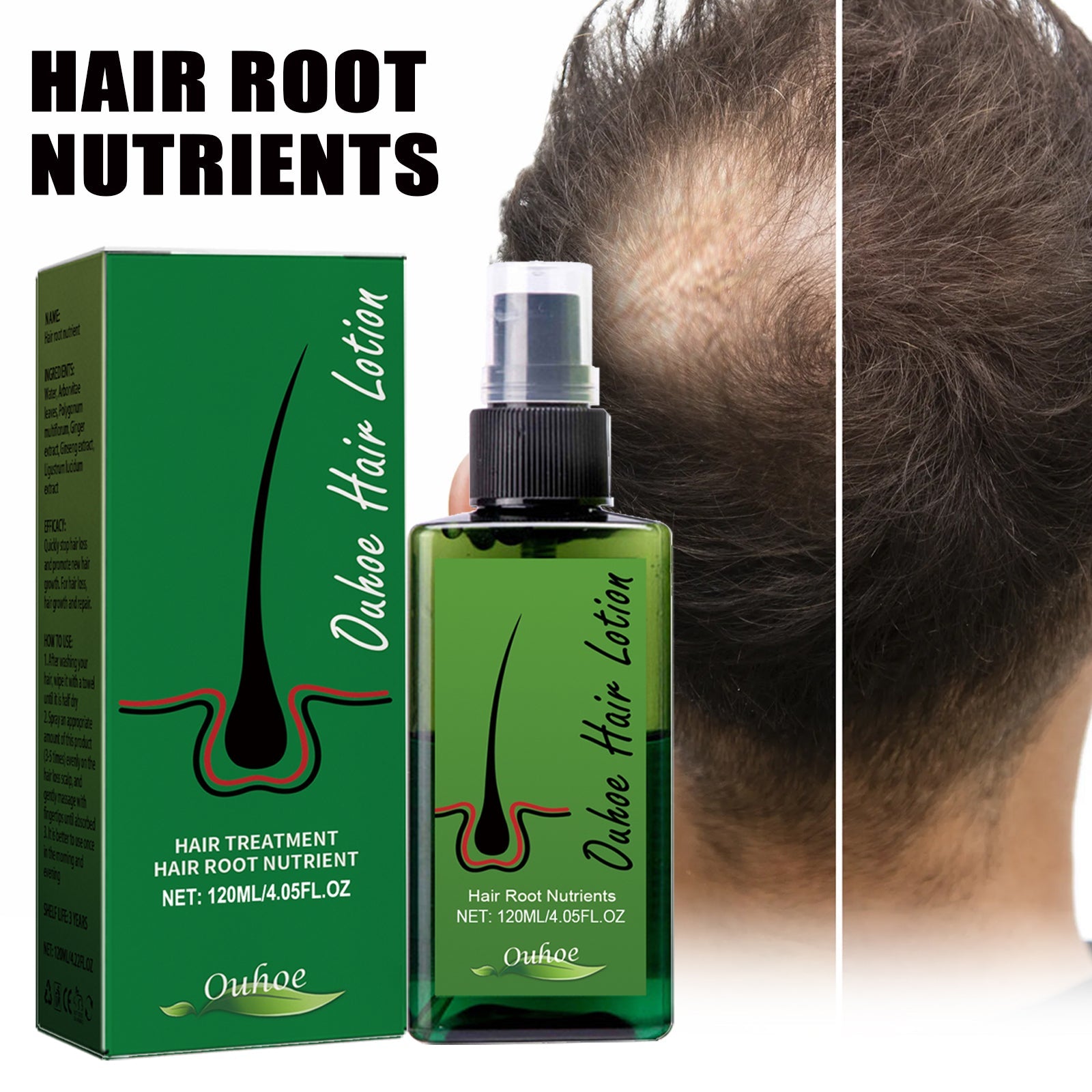 Dense Hair Spray, Anti-Loss Hair Strengthening Hair Repair Hair Root Hair Care Spray