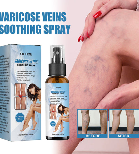 Vein Treatment Spray, Relieve Leg Soreness And Swelling Repair Earthworm Leg Vein Treatment Spray