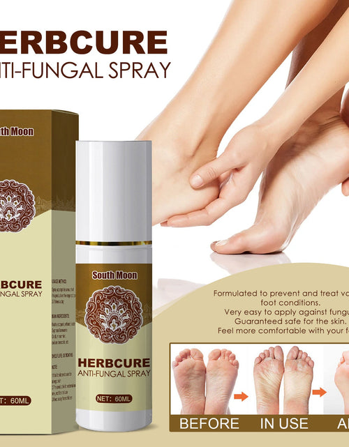 Load image into Gallery viewer, South Moon Herbal Foot Spray Moisturizes And Hydrates Foot Skin And Prevents Dry And Cracked Skin
