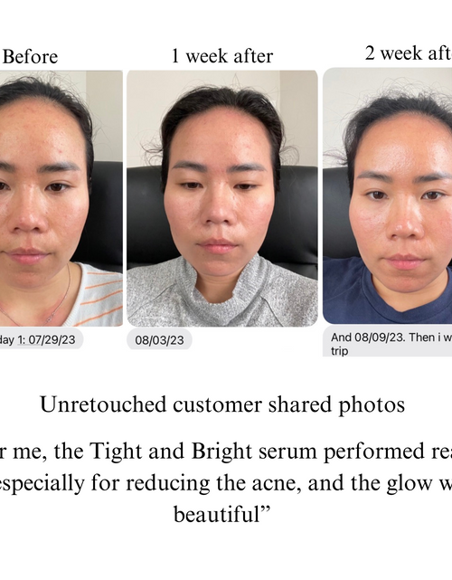 Load image into Gallery viewer, TIGHT AND BRIGHT, an Advanced Gentle Phyto-Retinol and Vitamin C Face Serum, 12 Innovative Technologies, 55% High-Performance Cosmeceuticals
