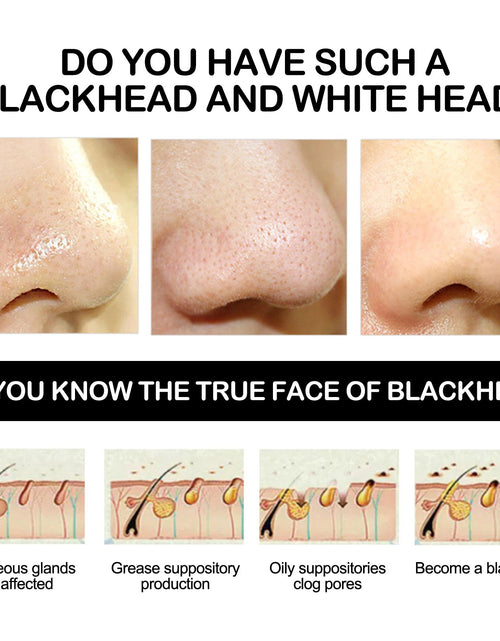Load image into Gallery viewer, EELHOE Bamboo Charcoal Blackhead Removing Tearing Facial Mask, Moisturizing Removing Blackhead And Acne Shrinking Pore Oil Control Mud Mask
