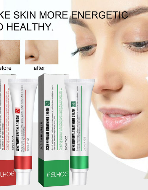 Load image into Gallery viewer, EELHOE Skin Care Cream Improves Dull Skin, Moisturizes Skin, Brightened Skin Care Cream And Clears Acne
