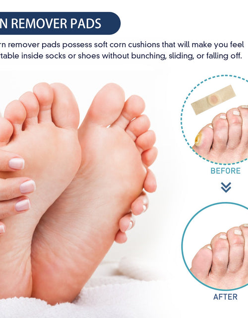 Load image into Gallery viewer, South Moon Gram Warty Corns Patch, Foot Soles Chicken Especially Clean Flesh Piercing Wart Wart Repair Patch Plain Sweat Tube Repair Patch

