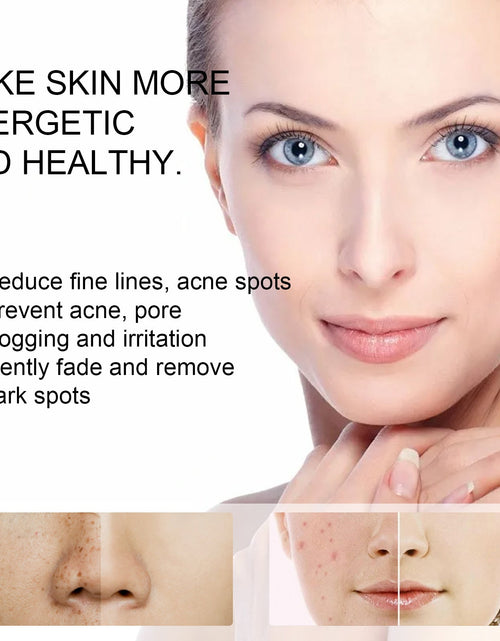 Load image into Gallery viewer, EELHOE Skin Care Cream Improves Dull Skin, Moisturizes Skin, Brightened Skin Care Cream And Clears Acne
