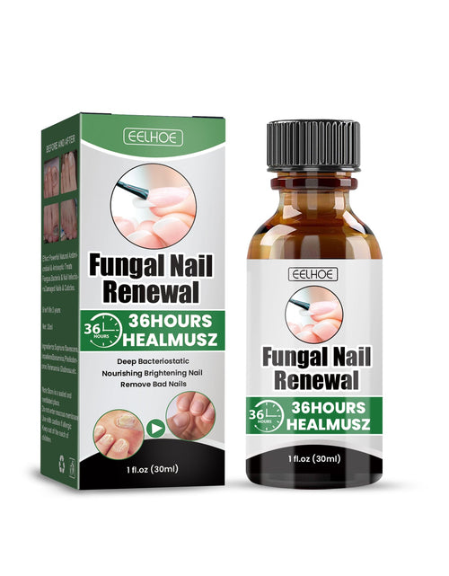 Load image into Gallery viewer, EELHOE Gray Nail Repair Remove Gray Nail Nourishing Lotion, Brightening Soft Nails Moisturizing Nail Care Solution For Hands, Feet And Nails
