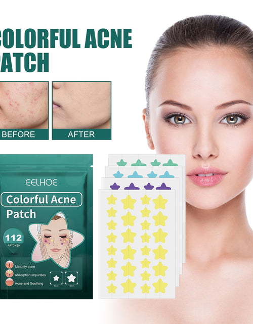 Load image into Gallery viewer, EELHOE Star Acne Patch Gentle Cleansing Lighten Acne Soothing Skin Acne Patch Facial Cleansing Treatment
