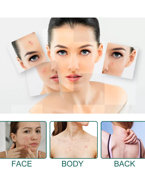 Load image into Gallery viewer, EELHOE Star Acne Patch Gentle Cleansing Lighten Acne Soothing Skin Acne Patch Facial Cleansing Treatment
