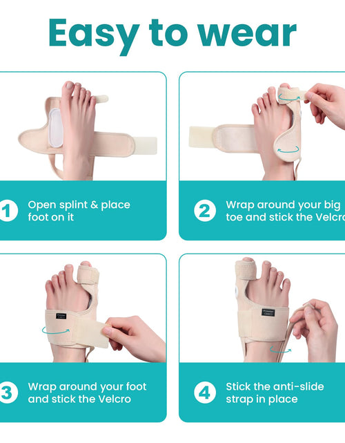 Load image into Gallery viewer, Promifun Bunion Corrector Adjustable Toe Splint Pain Relief Beige 1Pair One Size
