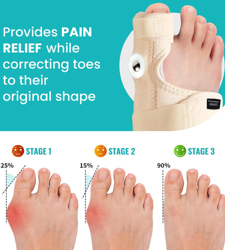 Promifun Bunion Corrector Adjustable Toe Splint Pain Relief Beige 1Pair One Size