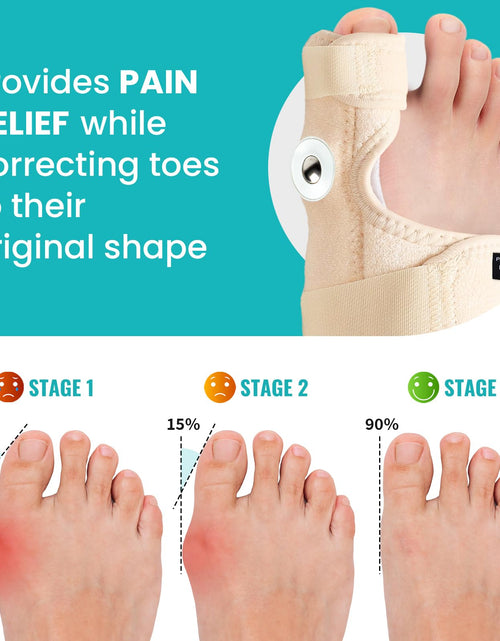 Load image into Gallery viewer, Promifun Bunion Corrector Adjustable Toe Splint Pain Relief Beige 1Pair One Size

