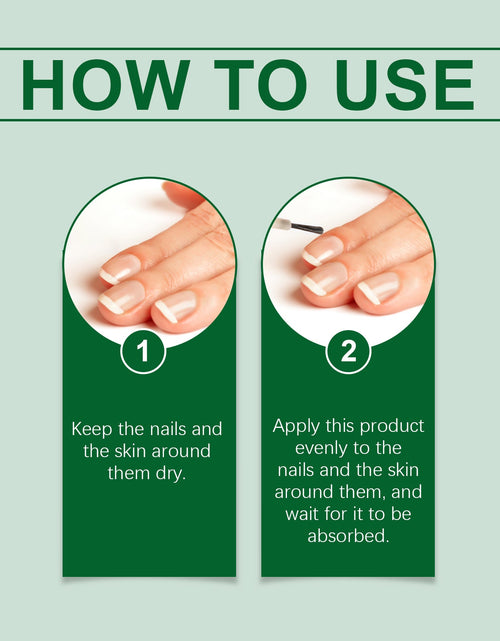 Load image into Gallery viewer, OUHOE Nail Care Solution, Gentle Repair, Clean, Nourish, Shine And Relieve Uncomfortable Nail Care Solution
