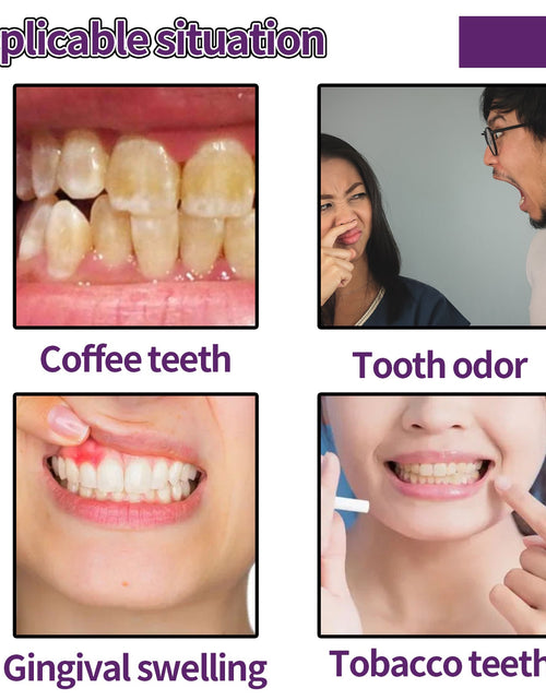 Load image into Gallery viewer, Oralhoe Repair Dental Tooth Powder, Whitening Tooth Powder Remove Yellow Mint Fresh Remove Residue To Clean Tooth Stains
