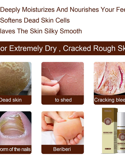 Load image into Gallery viewer, South Moon Herbal Foot Spray Moisturizes And Hydrates Foot Skin And Prevents Dry And Cracked Skin
