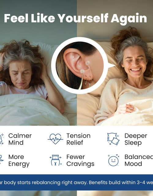 Load image into Gallery viewer, CalmPops Acupressure Ear Seeds Kit 24K Gold Plated 60 Units Immune Digestive
