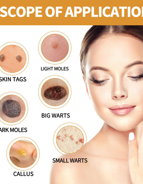 Load image into Gallery viewer, EELHOE Anti-Wart Serum, Deep Cleansing Smooth Skin Fade Hand, Foot And Corns Wart Wart Serum
