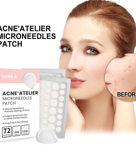 Acne Patch, Repair Acne Pimple Facial Redness Clean Pores Moisturize Skin Patch
