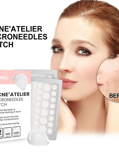 Load image into Gallery viewer, Acne Patch, Repair Acne Pimple Facial Redness Clean Pores Moisturize Skin Patch
