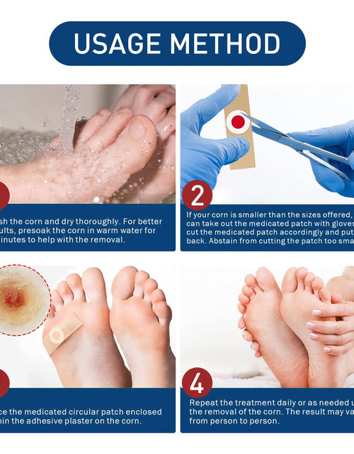 Load image into Gallery viewer, South Moon Gram Warty Corns Patch, Foot Soles Chicken Especially Clean Flesh Piercing Wart Wart Repair Patch Plain Sweat Tube Repair Patch
