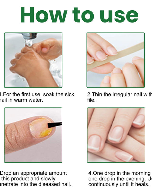 Load image into Gallery viewer, EELHOE Gray Nail Repair Remove Gray Nail Nourishing Lotion, Brightening Soft Nails Moisturizing Nail Care Solution For Hands, Feet And Nails
