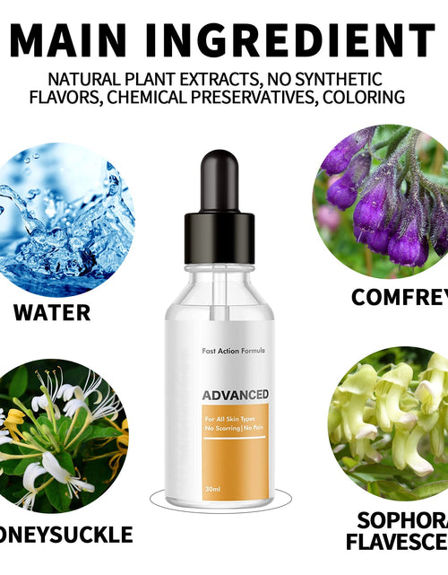 Load image into Gallery viewer, EELHOE Anti-Wart Serum, Deep Cleansing Smooth Skin Fade Hand, Foot And Corns Wart Wart Serum
