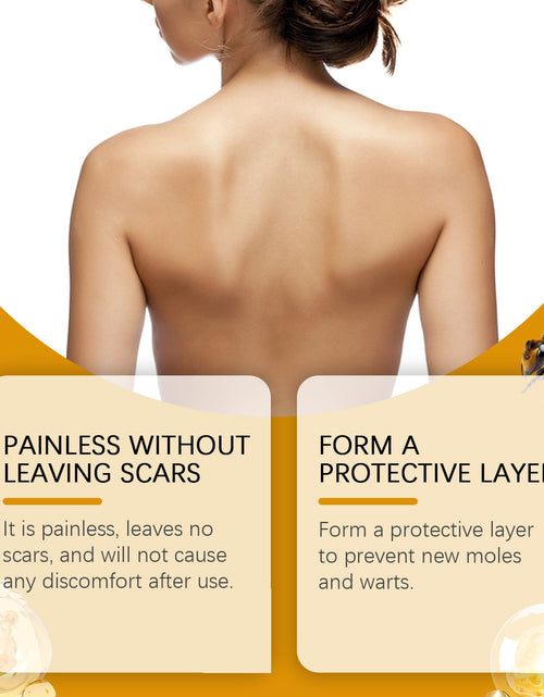 Load image into Gallery viewer, West&amp;Month Bee Venom Keyu Mole Care Cream, Moisturizes And Smoothes The Skin, Lightening The Skin Flesh Granules And Body Care
