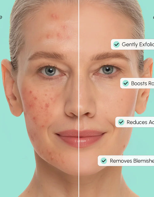 Load image into Gallery viewer, Azelaic Acid Soothing Pads
