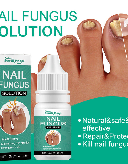 Load image into Gallery viewer, South Moon Nail Care Essence Moisturizes And Cleanses Hands, Feet And Nails And Brightening Nails Daily Care Essence
