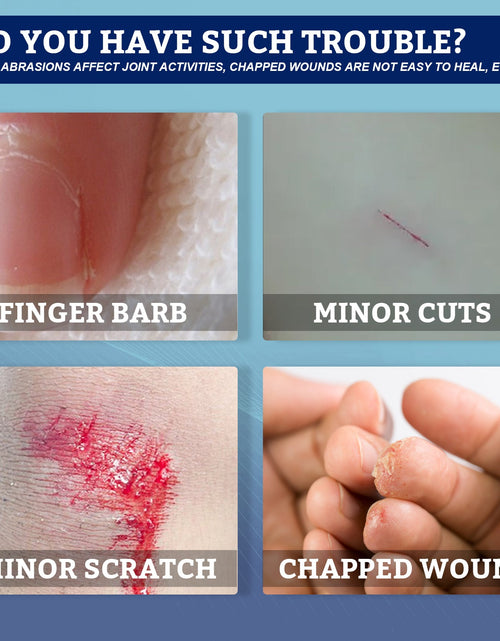 Load image into Gallery viewer, Skin Repair Patch, Waterproof, Secure And Gentle Skin Repair Daily Care
