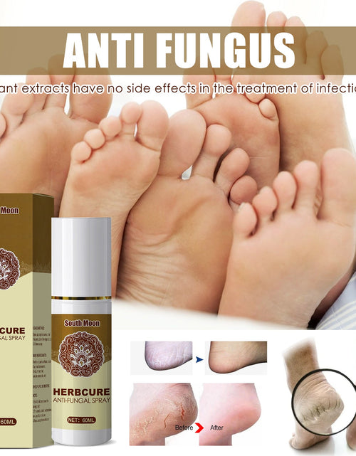 Load image into Gallery viewer, South Moon Herbal Foot Spray Moisturizes And Hydrates Foot Skin And Prevents Dry And Cracked Skin
