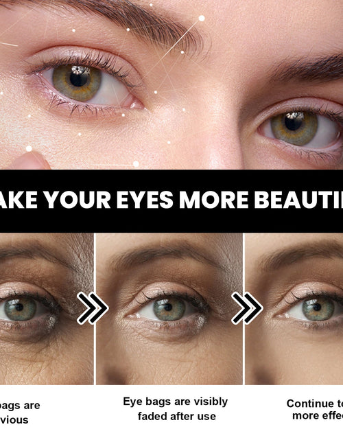 Load image into Gallery viewer, Eye Firming Cream, Relieves Bags, Black Eyes, Firms, Moisturizes, Repairs Skin Eyes Cream
