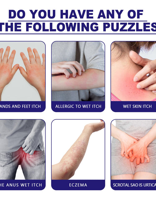 Load image into Gallery viewer, South Moon Zihuadidian Skin Care Cream For Mosquito Bites And Red Skin Topical Care Cream

