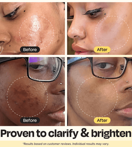 Vitamin C Clay Mask