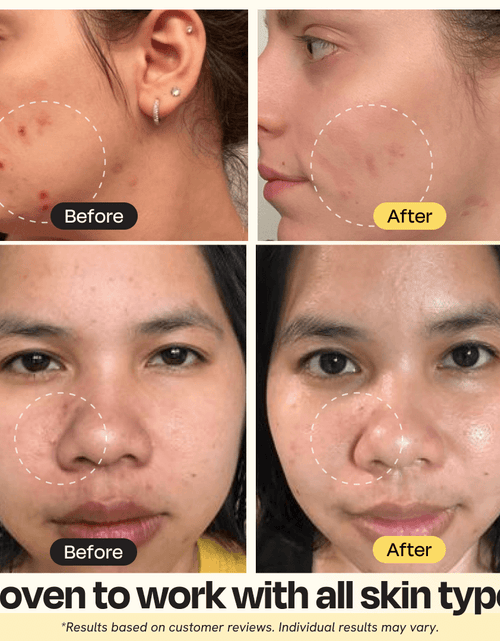 Load image into Gallery viewer, Vitamin C Clay Mask
