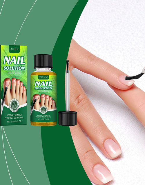 Load image into Gallery viewer, OUHOE Nail Care Solution, Gentle Repair, Clean, Nourish, Shine And Relieve Uncomfortable Nail Care Solution
