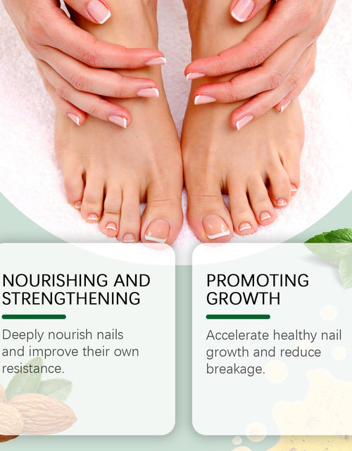 Load image into Gallery viewer, OUHOE Nail Care Solution, Gentle Repair, Clean, Nourish, Shine And Relieve Uncomfortable Nail Care Solution
