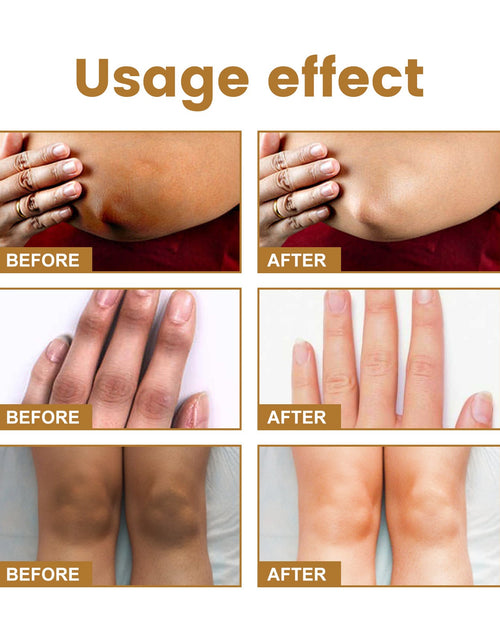 Load image into Gallery viewer, Jaysuing Knuckle Acanthosis Melanin Whitening Serum For Hand And Joint Skin
