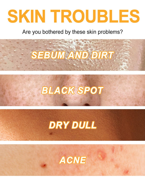 Load image into Gallery viewer, EELHOE Exfoliating Gel For Deep Cleansing, Anti-Acne Blackheads, Moisturizing Skin, Shrinking Pores And Brightening Gel
