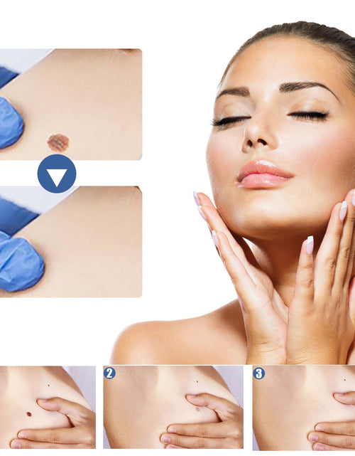 Load image into Gallery viewer, EELHOE Gram Wart Corns Patch, Skin Gram Wart Flesh Mole Black Mole Clean And Care Patch
