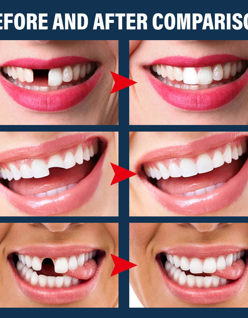 Load image into Gallery viewer, EELHOE Denture Decorative Teether Set, Halloween Vampire Makeup Dress Up Fake Tooth Glue Teeth Props
