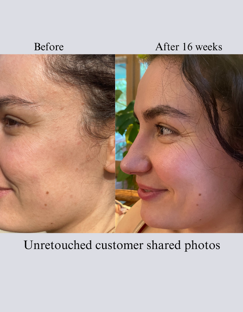 Load image into Gallery viewer, TIGHT AND BRIGHT, an Advanced Gentle Phyto-Retinol and Vitamin C Face Serum, 12 Innovative Technologies, 55% High-Performance Cosmeceuticals
