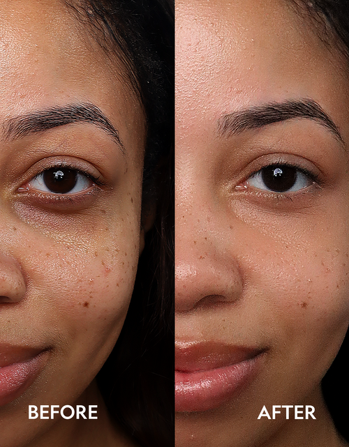 Load image into Gallery viewer, Super Bright Dark Circle Serum Peptide Corrector
