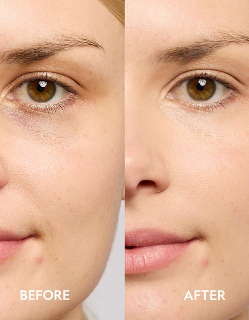 Load image into Gallery viewer, Super Bright Dark Circle Serum Peptide Corrector
