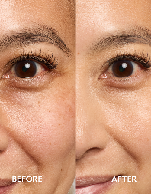 Load image into Gallery viewer, Super Bright Dark Circle Serum Peptide Corrector
