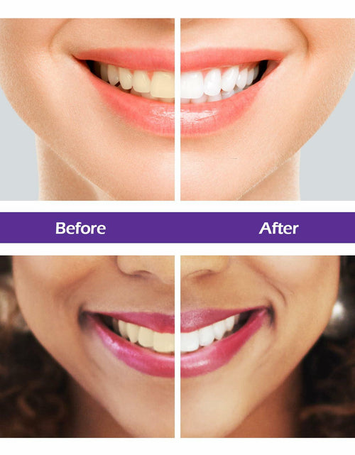 Load image into Gallery viewer, BestBy10/25 Rabbitooth Purple Teeth Whitening Serum 30ml Non-invasive Zero
