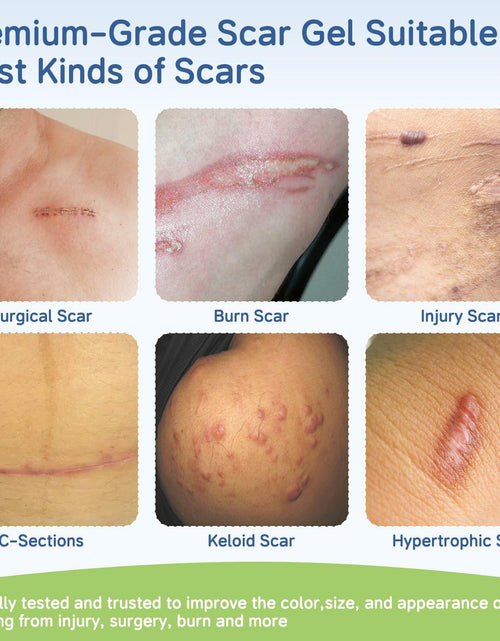 Load image into Gallery viewer, BestBy06/27 SLUKHIG Silicone Scar Gel 1.76oz Surgical &amp; Burn Scar TreatmentCream
